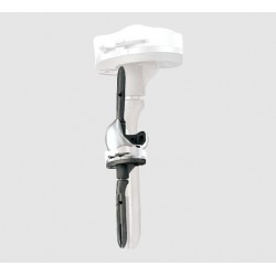 Revision Knee System