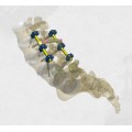 Spinal Fixation